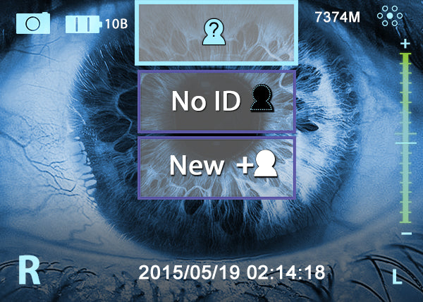 Miis Fundus Camera — imagen de detalle 5 de 9