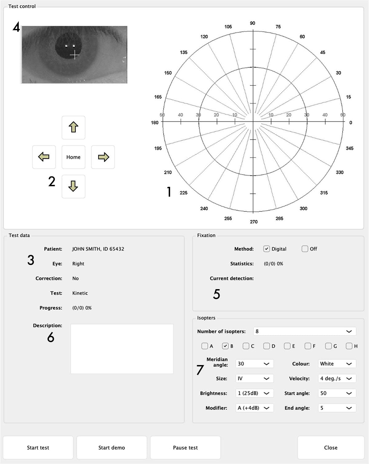 Frey Perímetro AP-600 — imagen de detalle 12 de 23