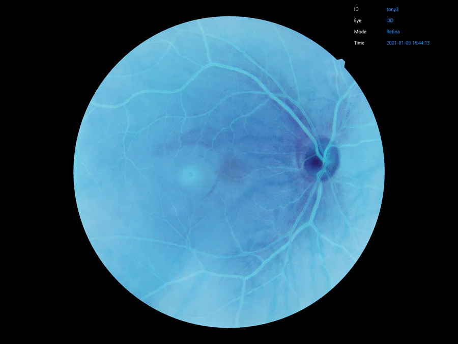 Ezer Cámara Retinal EFC-2600 — imagen de detalle 19 de 23