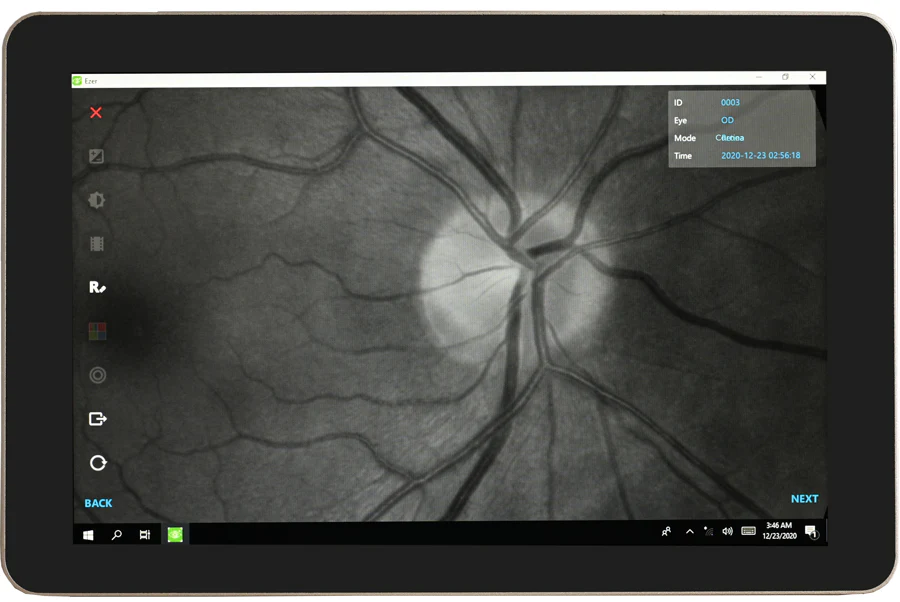 Ezer Cámara Retinal EFC-2600 — imagen de detalle 17 de 23