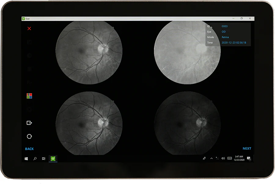 Ezer Cámara Retinal EFC-2600 — imagen de detalle 18 de 23