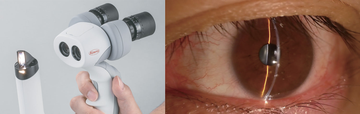 Kowa Lámpara de Hendidura Portable SL-19 — imagen de detalle 2 de 4