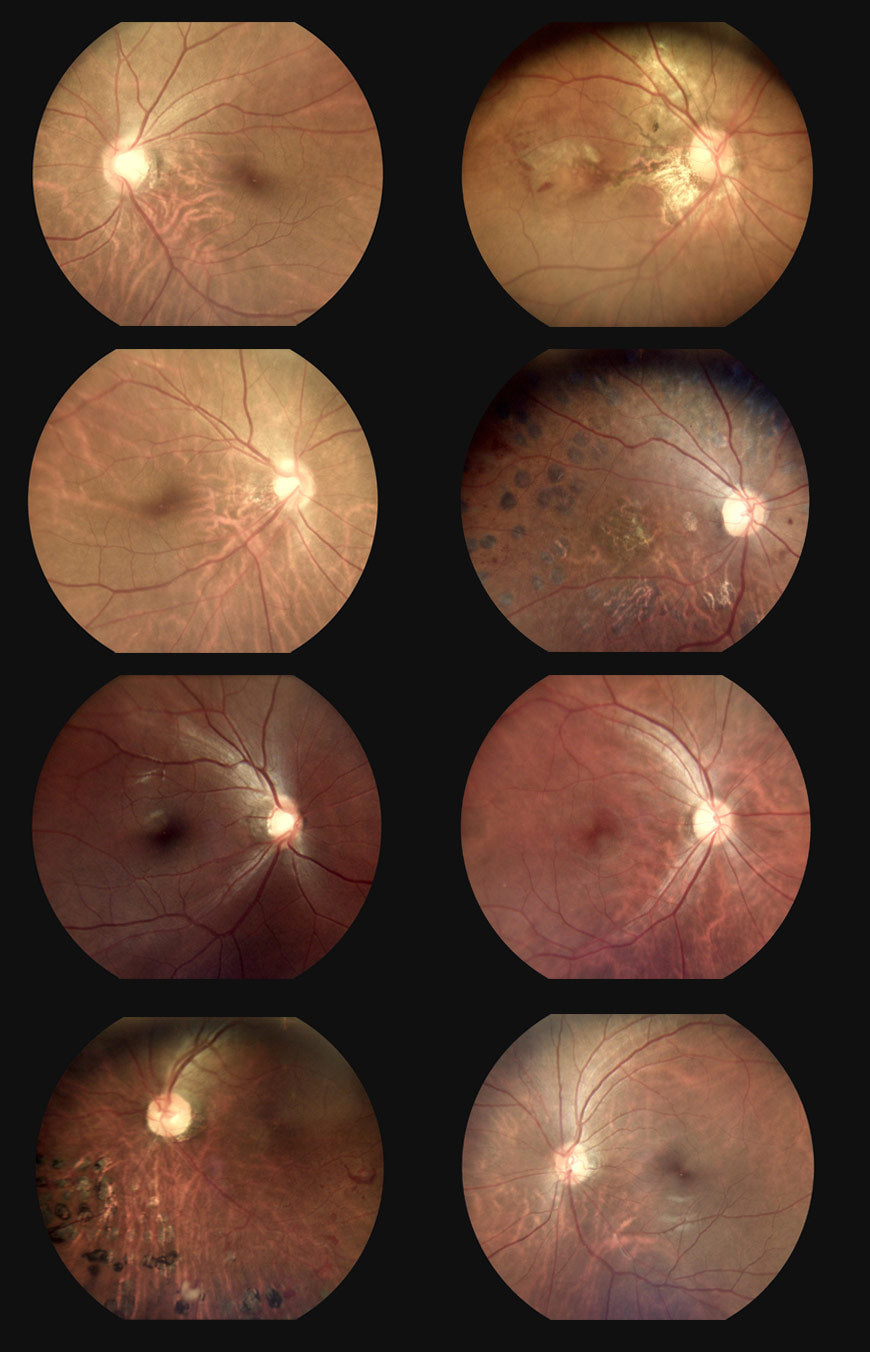 Miis Fundus Camera — imagen de detalle 4 de 9