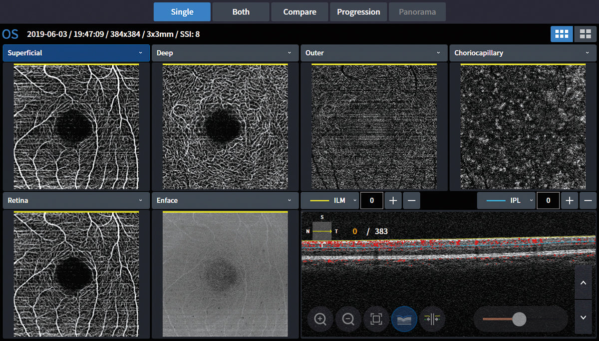 Huvitz Módulo de Angiografía H Angio Module — imagen de detalle 5 de 13