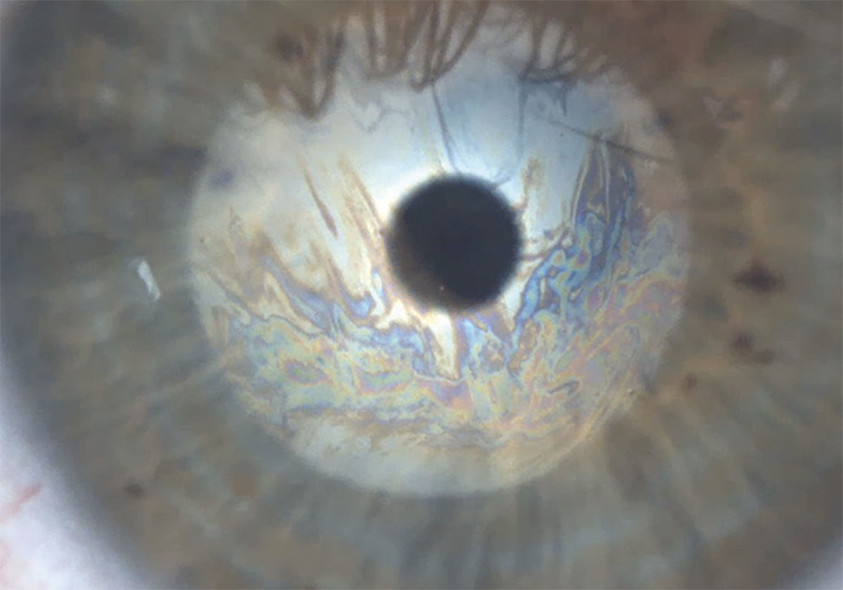 Ezer Ojo Seco Sapphire A — imagen de detalle 3 de 37