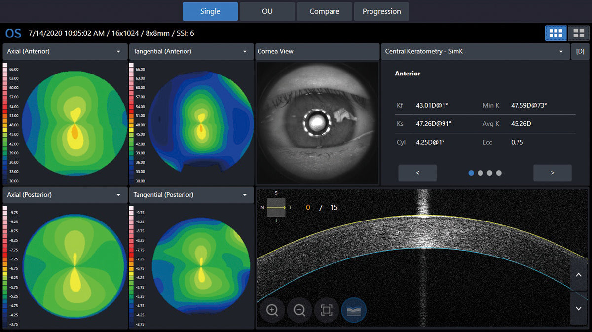 Huvitz Módulo de Topografía HOCT-Topography Module — imagen de detalle 1 de 10