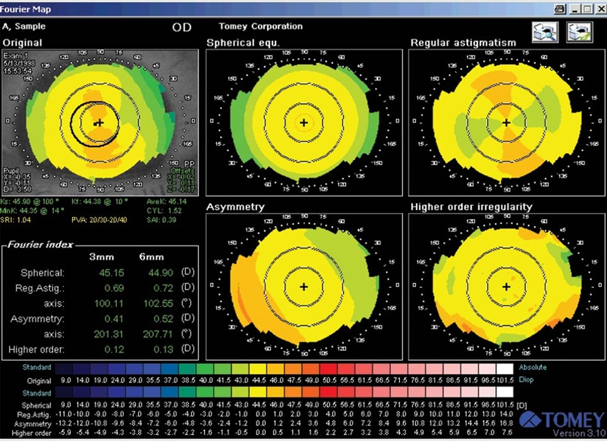 Tomey Topografía Corneal TMS-4N — imagen de detalle 1 de 5