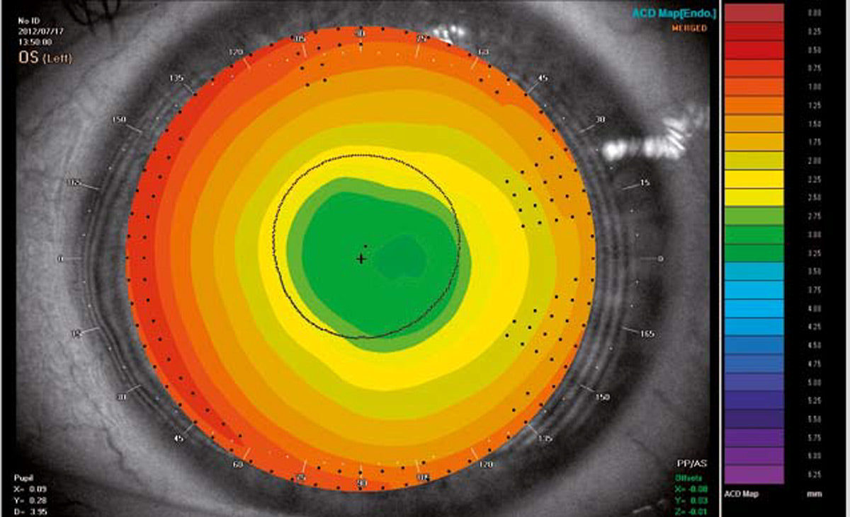 Tomey Topografía Corneal TMS-4N — imagen de detalle 3 de 5