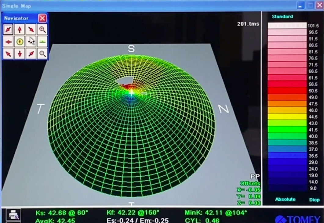 Tomey Topografía Corneal TMS-4N — imagen de detalle 4 de 5