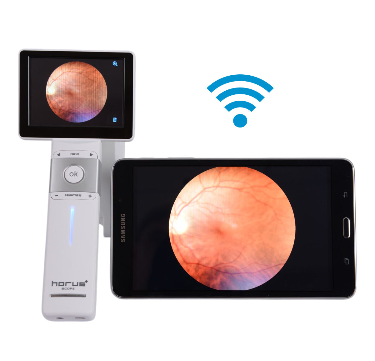 Miis Fundus Camera — imagen de detalle 7 de 9